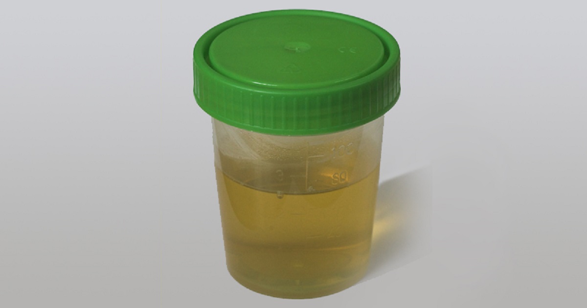 Il colore giallo dell’urina è dovuto a un enzima scoperto di recente