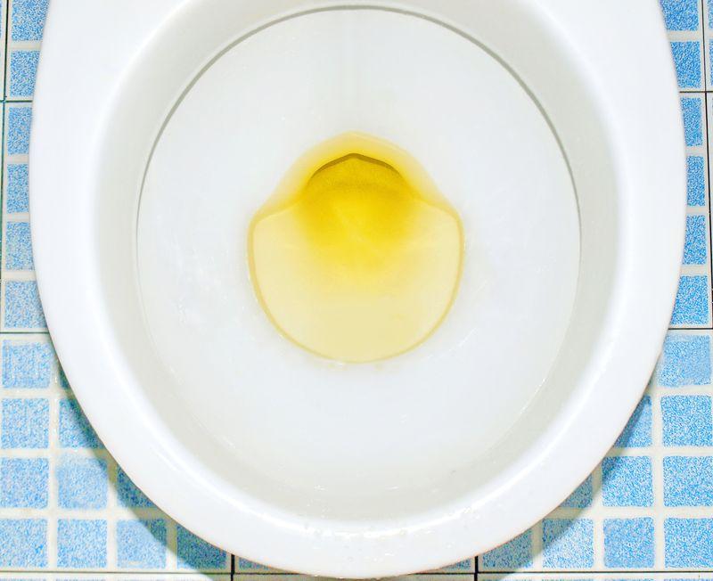 Come l’urina ottiene il suo colore giallo: la scoperta di un nuovo enzima prodotto dai batteri intestinali