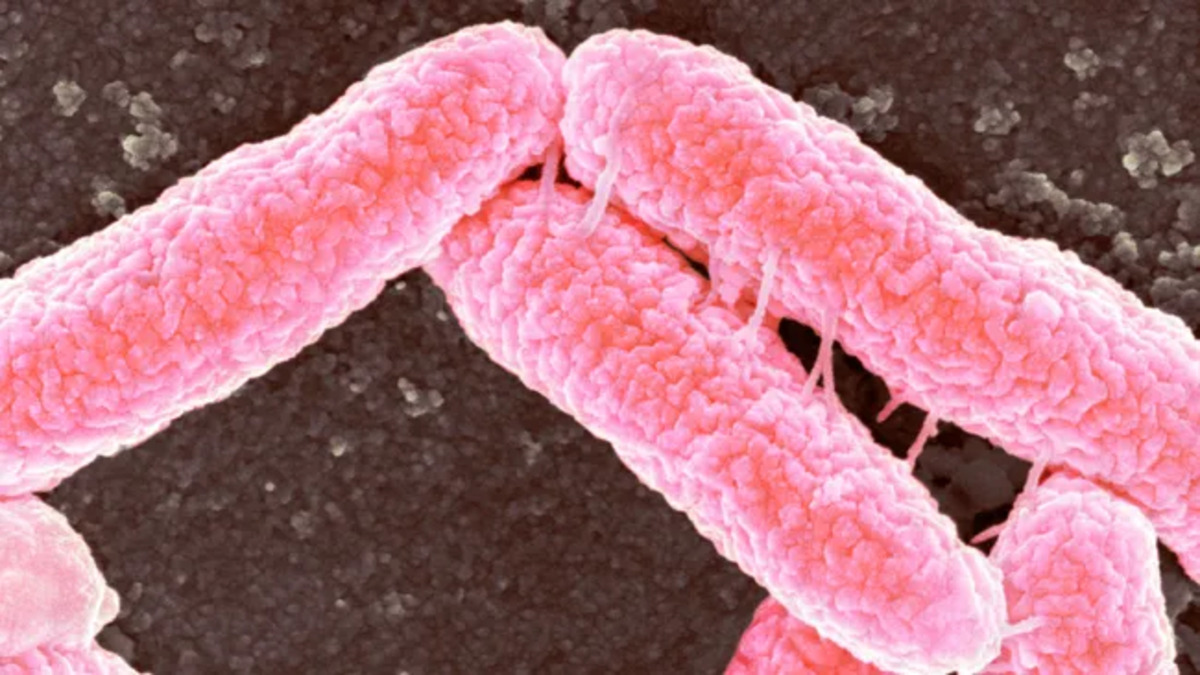 I superbatteri possono persistere nel corpo per anni. Lo studio
