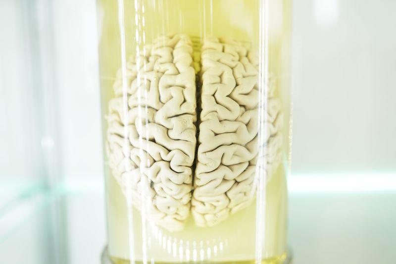 Cervello umano in un barattolo (esemplare reale)