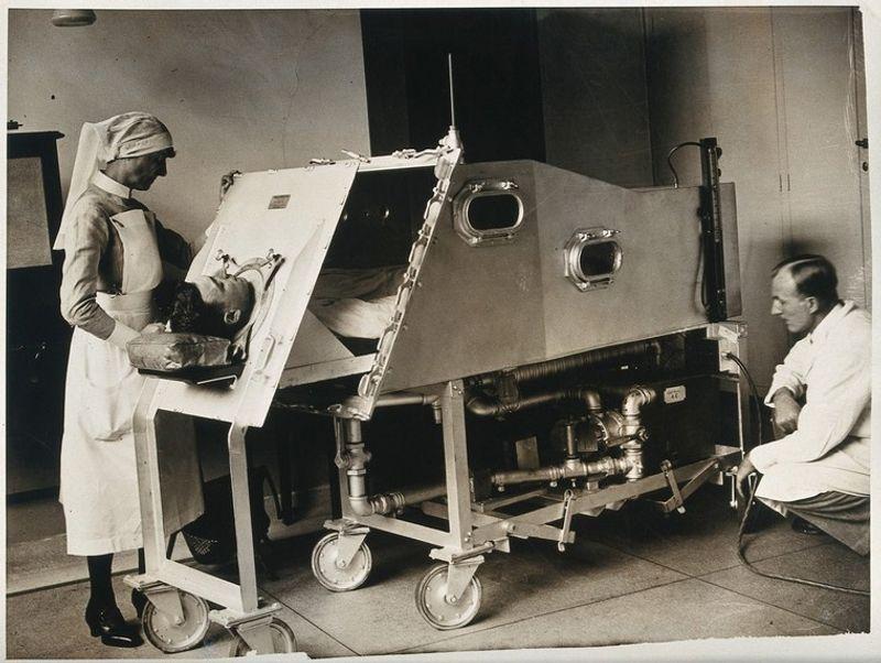 fotografia in bianco e nero degli anni '30 di un paziente e un'infermiera con un polmone d'acciaio presso l'Ospedale St. Bartholomew di Londra.
