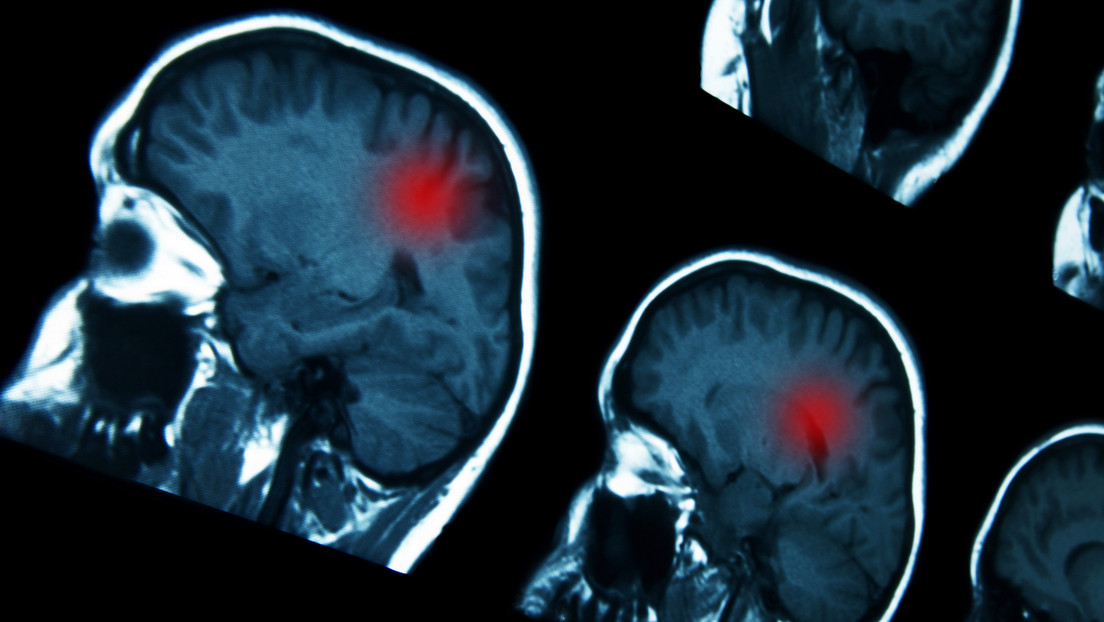 Alcuni farmaci ormonali sono legati ad un aumento del rischio di tumori al cervello