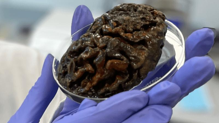 Cervelli umani antichi: segreti di una straordinaria conservazione