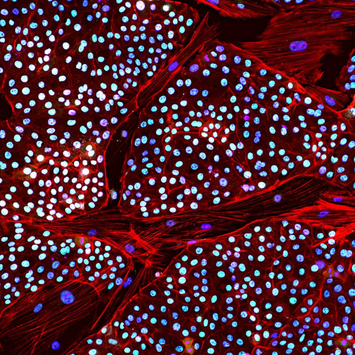 cellula staminale pluripotente indotta dall'elefante