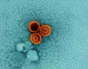 Un micrografo elettronico che mostra tre virioni di EBV in rosso-arancio su uno sfondo blu-verde