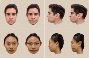 Immagini generate al computer delle distorsioni di un volto maschile (in alto) e di un volto femminile (in basso), come percepito dal paziente nello studio.