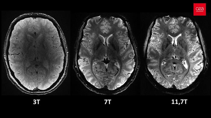 scansioni del cervello utilizzando macchine MRI da 3T, 7T e 11,7T affiancate