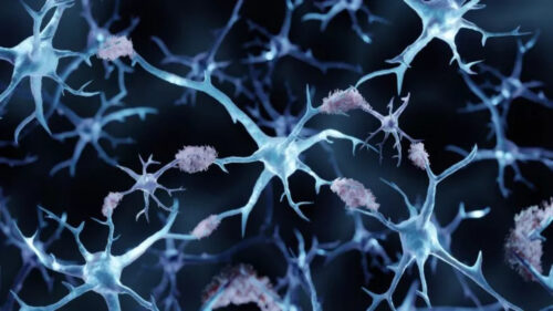 Scienziati scoprono un possibile nuovo trattamento per l’Alzheimer