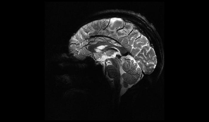 vista sagittale del cervello umano ottenuta utilizzando uno scanner MRI da 11,7 tesla; immagine in bianco e nero del cervello con tessuti e strutture chiaramente mostrati in scala di grigi
