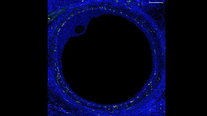 Un grande disco circolare nero occupa la maggior parte dell'immagine quadrata, con un disco ovale nero più piccolo che abbraccia il suo bordo. Le loro dimensioni relative sono simili a un pisello e un seme di papavero anche se il disco più grande è largo solo circa un millimetro. Entrambi sono delineati in blu, le cellule illuminate con marcatori fluorescenti. Punti gialli tracciano cerchi intorno al grande disco.