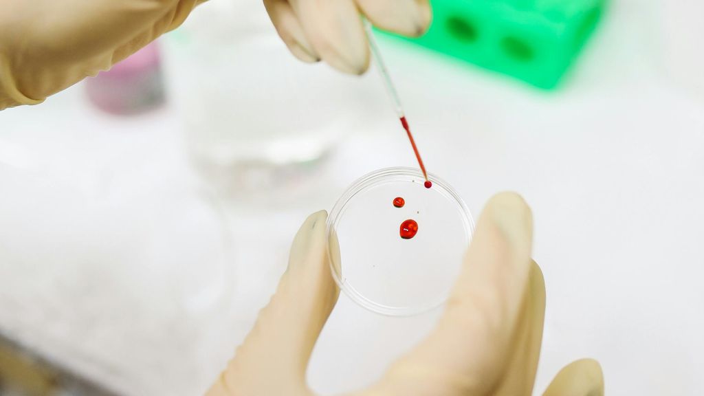 Scoperti batteri “vampiri” attratti dal sangue potenzialmente fatali