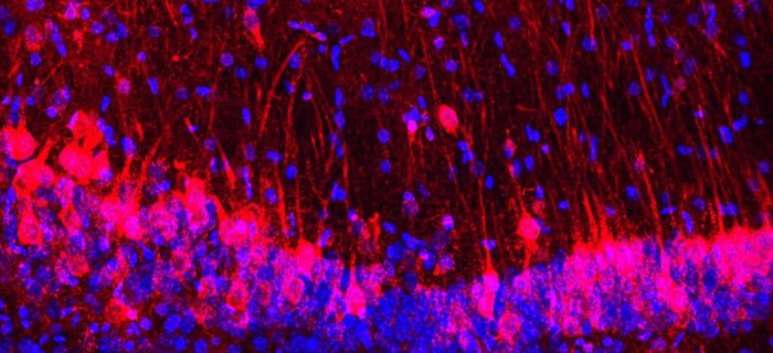 dettaglio dei neuroni nell'ippocampo del topo etichettati in rosso e blu