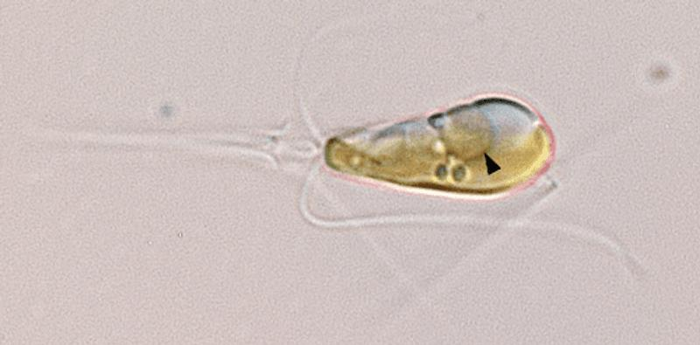 Un'immagine al microscopio ottico mostra l'alga marina haptophyte Braarudosphaera bigelowii con una freccia nera che indica l'organello nitroplast