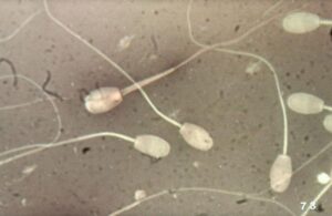 Microplastiche nei Testicoli: Impatto sul Sistema Riproduttivo Umano e Canino
