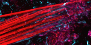 immagine al microscopio che mostra il fascio di fibre dell'elettrodo in rosso