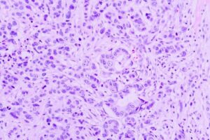 Cellule polmonari umane al microscopio