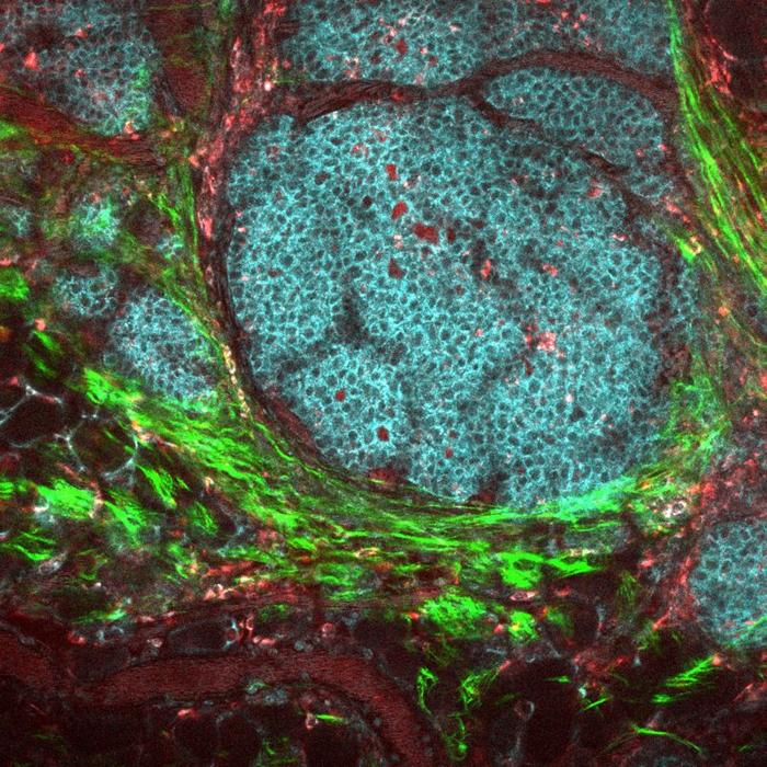 breast-tumor-microenvironment-m-1.jpg