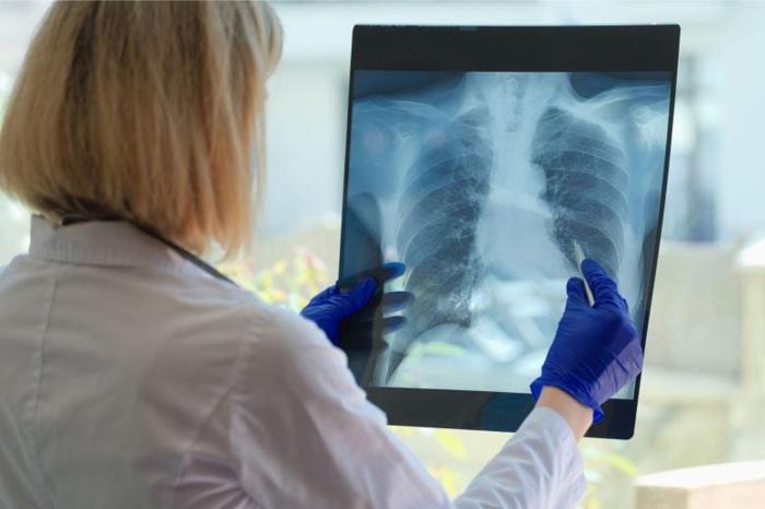 Doctor-Lungs-MRI-777x518-1-1.jpg