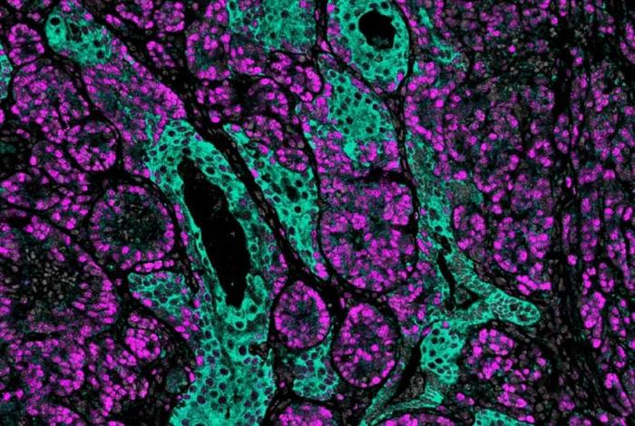 Drug-Resistant-Prostate-Cancer-Cells-777x522-1-1.jpg