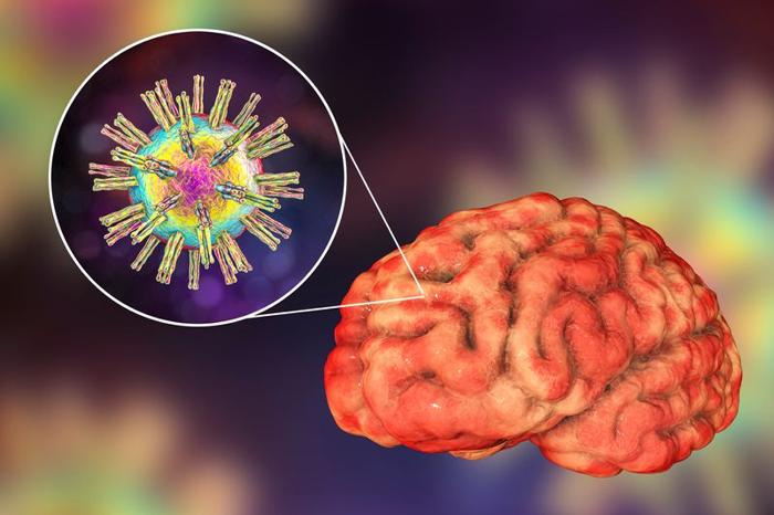 herpes-simplex-virus-type-1-and-the-brain-m-1.jpg
