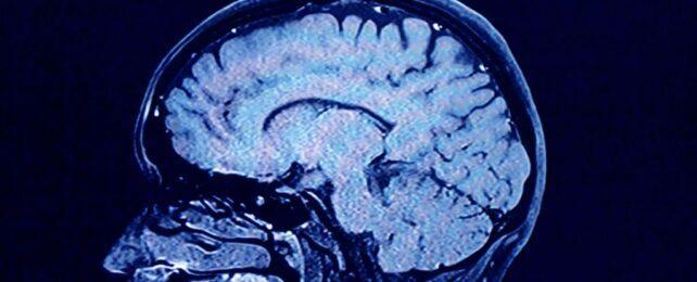 BrainScanLongCOVID-642x260-1-1.jpg