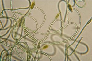 Cyanobatteri