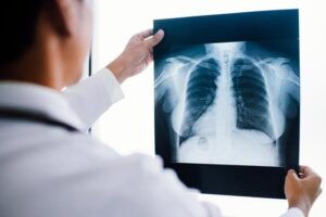 Esame del medico del torace a raggi X