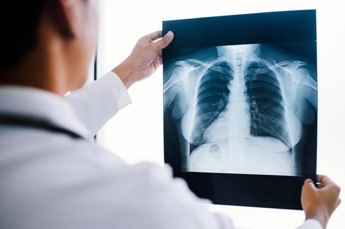 Esame del medico del torace a raggi X