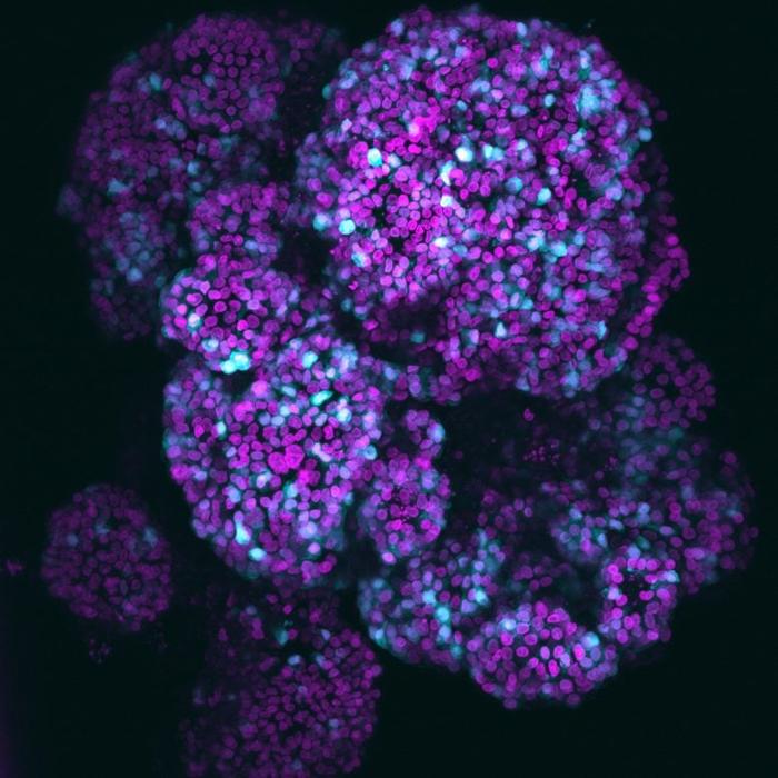 Human-Fetal-Pancreatic-Organoid-With-Acinar-Cells-777x777-1-1.jpg