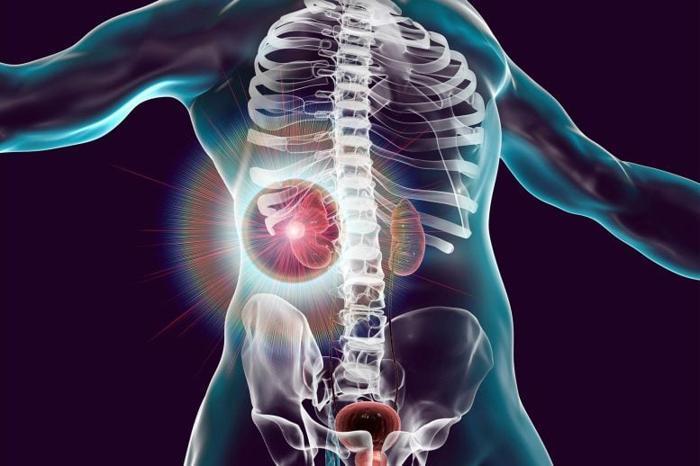 Concetto di trattamento del cancro al rene