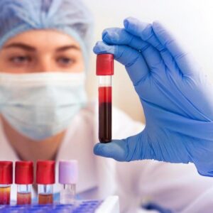 Tubi per test del sangue medico