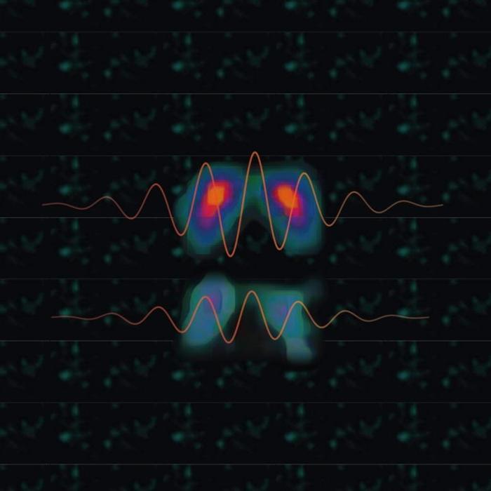 Nuova Prospettiva sul Tremore nella Malattia di Parkinson
