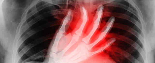 XrayShowsRedHeartPain-642x260-1-1.jpg