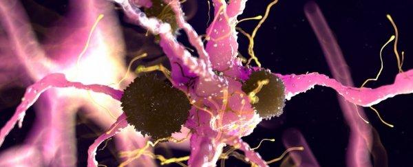 parkinsonslewybody_600-1.jpg