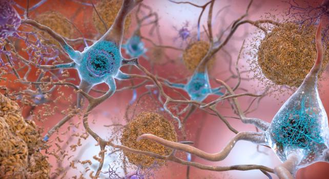 Uno studio sui topi suggerisce un legame sorprendente tra l'Alzheimer e il grattarsi il naso