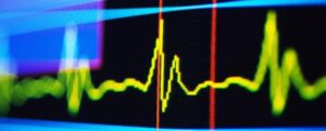 Monitoraggio della frequenza cardiaca