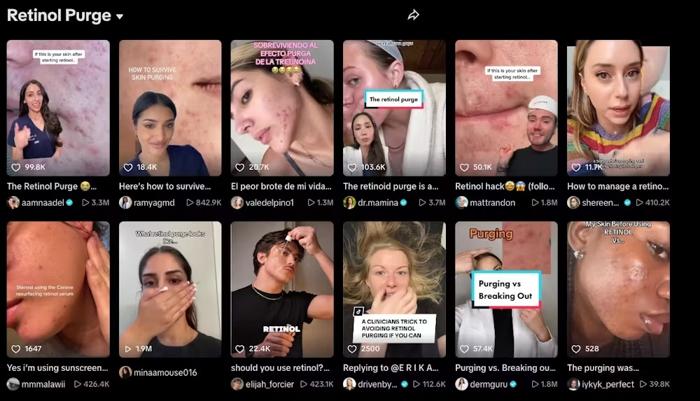 screenshot dei risultati di ricerca di tiktok per il purging da retinolo, con molte miniature diverse di video che trattano l'argomento