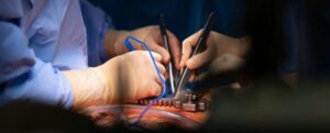 I chirurghi rianimano un cuore 'morto' in un trapianto d'organo salvavita per un bambino