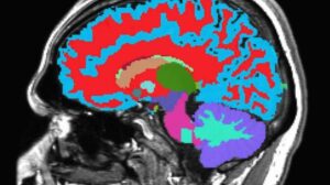 Gli scienziati di Harvard e Duke decifrano l'orologio dell'invecchiamento del cervello utilizzando una singola scansione MRI