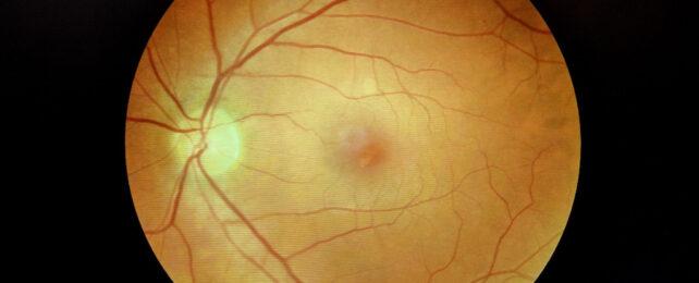 human-retina-642x260-1.jpg