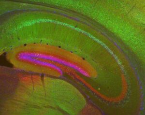 Ippocampo di un topo transgenico Nr4a1-eGFP (verde) colorato per calbindina (rosso) e DAPI per mostrare i nuclei (blu). Epifluorescenza. Categorie: Ricerca nei laboratori e cliniche NIH Tipo: Colore, Foto Fonte: Istituti Nazionali della Salute (NIH)