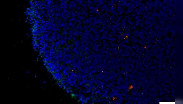 Immagine al microscopio di un organoide retinico umano esposto al SARS-CoV-2