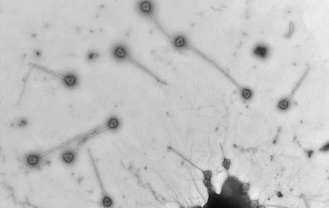 Micrografia in scala di grigi di strutture arrotondate con lunghe protrusioni sottili