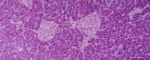 Cellule pancreatiche