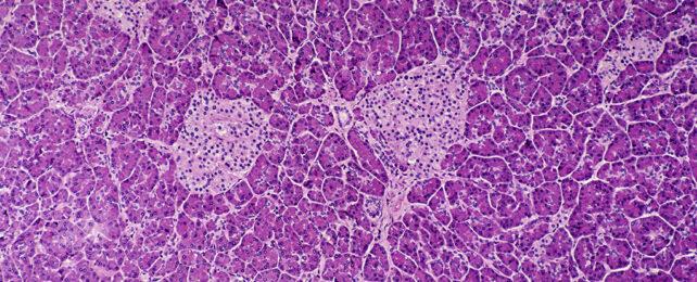 PancreaticCells-642x260-1.jpg