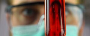 Scienziato con campione di sangue