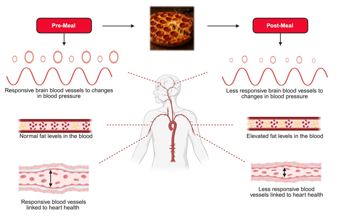 Diagramma che mostra come i grassi possano indurire le arterie