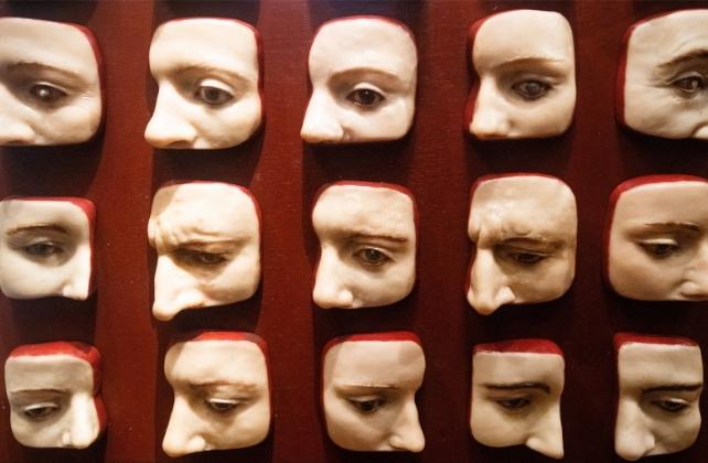 Calchi di cera delle malattie oculari, mostrati in viste laterali di volti umani su uno sfondo rosso