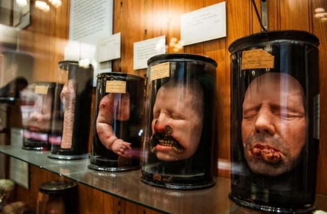 Calchi di cera di volti e parti del corpo, in barattoli in un museo