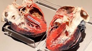 Il metodo del vetro ionico della Cina rende cervelli e cuori trasparenti per la mappatura 3D
